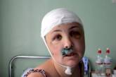Врач рассказала, как во Врадиевской больнице спасали жизнь Ирины Крашковой