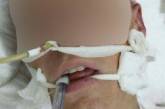 19-летний николаевский десантник, раненный на Донбассе, в крайне тяжелом состоянии