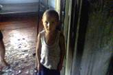 Во Врадиевке 4-летний мальчик поджег свой дом