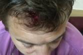 В Херсоне во время митинга  избили журналиста. ВИДЕО  
