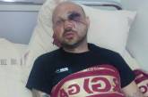 В Николаеве охранник автовокзала избил экс-активиста «Правого сектора»