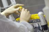 В Украине зафиксированы пять смертей от гриппа