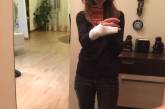 В Киеве коп сломал руку девушке, которая отказалась предъявлять права