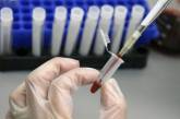 Гепатит А в Николаеве: количество заболевших увеличилось до 62 человек