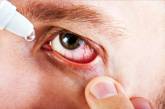 В Украине запретили популярное лекарство от воспаления глаз