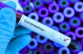 Диагностика, сроки, результаты: что нужно знать о тест-системах для выявления коронавируса