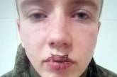 Российский солдат зашил себе рот - в части заявляют, что из-за ссоры с девушкой