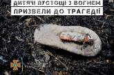 В Одесской области маленький мальчик получил 90% ожогов тела, играя с зажигалкой