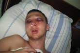 В Николаеве зверски избили студента: сторона потерпевшего настаивает, что бил милиционер