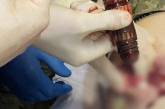 Украинские хирурги с саперами успешно извлекли боевую часть гранаты из тела раненного бойца (фото)