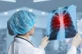 «Болезнь бедных»: в ОВА заявили о росте количества заболевших туберкулезом в Николаеве и области