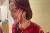 Избиение девушки костылями: в Одесском ТЦК проведут проверку