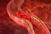 Прохладный душ «освобождает» артерии от холестерина – эксперты 