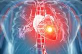 Симптомы острого инфаркта миокарда можно спутать с болью в спине – кардиолог 