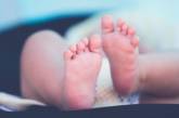 Немовля народилося із 10-сантиметровим хвостом – відео