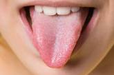 Про які небезпечні хвороби може розповісти колір язика