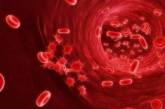 Онкологи озвучили вероятные причины развития рака крови