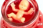Аборт способен программировать бесплодие рода