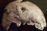 Американцы идентифицировали череп Гитлера как женский