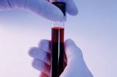 Впервые в мире пациенту перелили искусственную кровь
