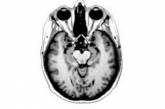Нейробиологи исследовали мозг обладателей автобиографической памяти