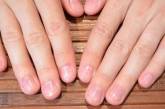 Названы 15 эффективных способов укрепления ногтей
