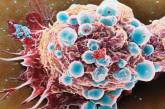 Лекарство от рака груди способно подавлять другие опухоли