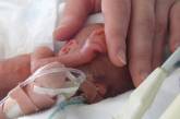 ВОЗ: Ежегодно во всем мире около 15 млн детей рождаются преждевременно 