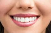 Стоматологи назвали продукты, "убивающие" белизну зубов