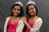 Разделенные сиамские близнецы отпраздновали 16-летие. ФОТО