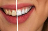 Названы главные причины пожелтения зубов
