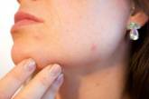 Названы серьезные заболевания, о которых может сигнализировать кожа