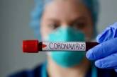 Медики рассказали, как коронавирус меняет цвет мочи