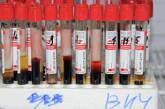 Российская вакцина от ВИЧ проходит клинические испытания