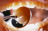 Ученые разработали способ, как лечить зубы и не сверлить их 