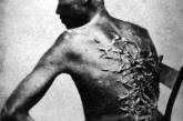 Бывший раб показывает свои шрамы от битья, США, 1863 г. ФОТО