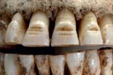 Зубы датского викинга, 972-1025 н. э. ФОТО