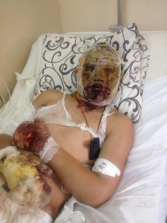 Российский танкист, раненый под Дебальцево: «Мы все знали, на что идем»