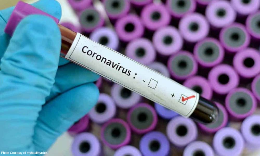 Что нужно знать о коронавирусе