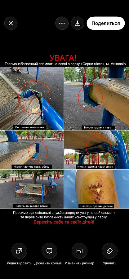 В Николаеве ребенок получил серьезную травму в парке «Сердце города» (фото, видео) В Николаеве ребенок получил серьезную травму в парке «Сердце города» (фото, видео)