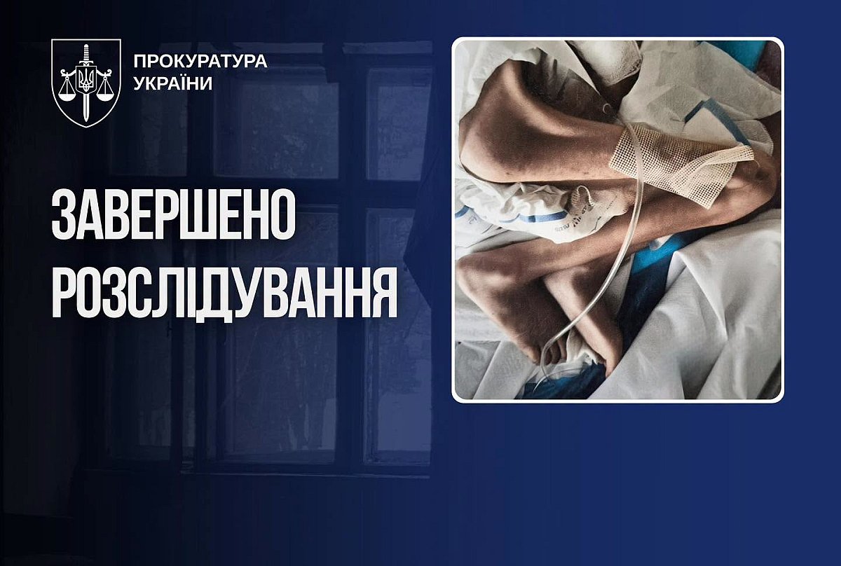 Ребенок с ДЦП в 11 лет весил 14 килограммов: мать предстанет перед судом Ребенок с ДЦП в 11 лет весил 14 килограммов: мать предстанет перед судом