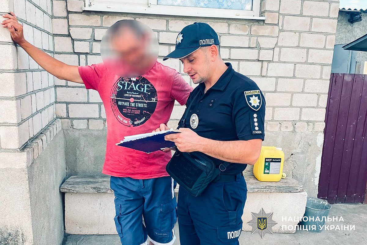 В Вознесенске собака укусила ребенка за лицо: владельцу грозит штраф и конфискация В Вознесенске собака укусила ребенка за лицо: владельцу грозит штраф и конфискация
