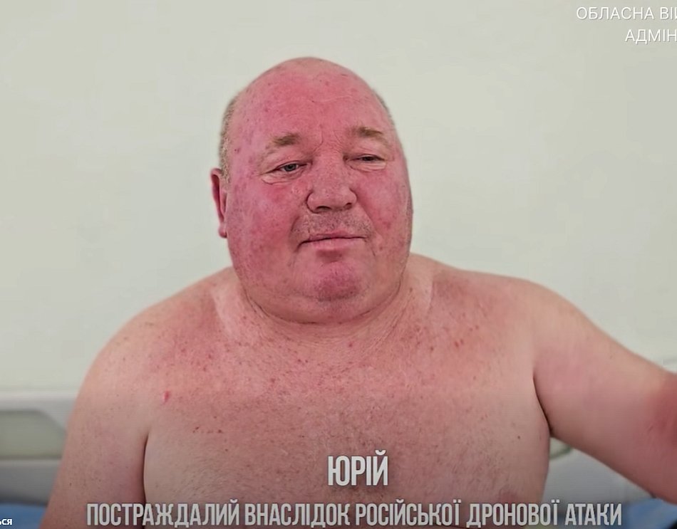 «Жена убежала, а дрон начал охоту»: появились новые подробности атаки на фермера из Николаевщины в Херсоне (видео) «Жена убежала, а дрон начал охоту»: появились новые подробности атаки на фермера из Николаевщины в Херсоне (видео)