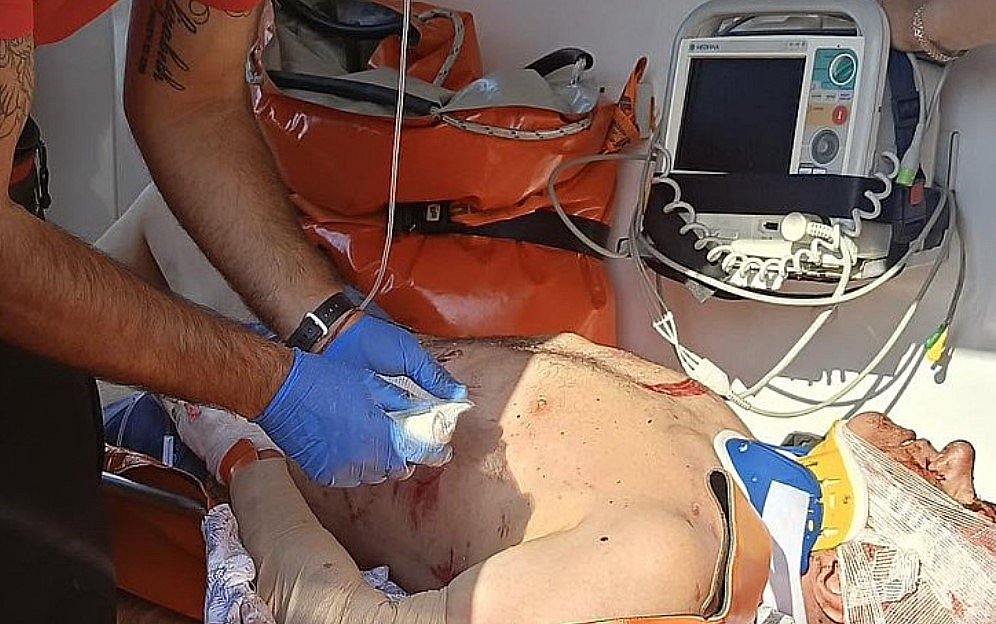ДТП с фурой под Николаевом: водитель легковушки погиб, пассажирка в тяжелом состоянии ДТП с фурой под Николаевом: водитель легковушки погиб, пассажирка в тяжелом состоянии