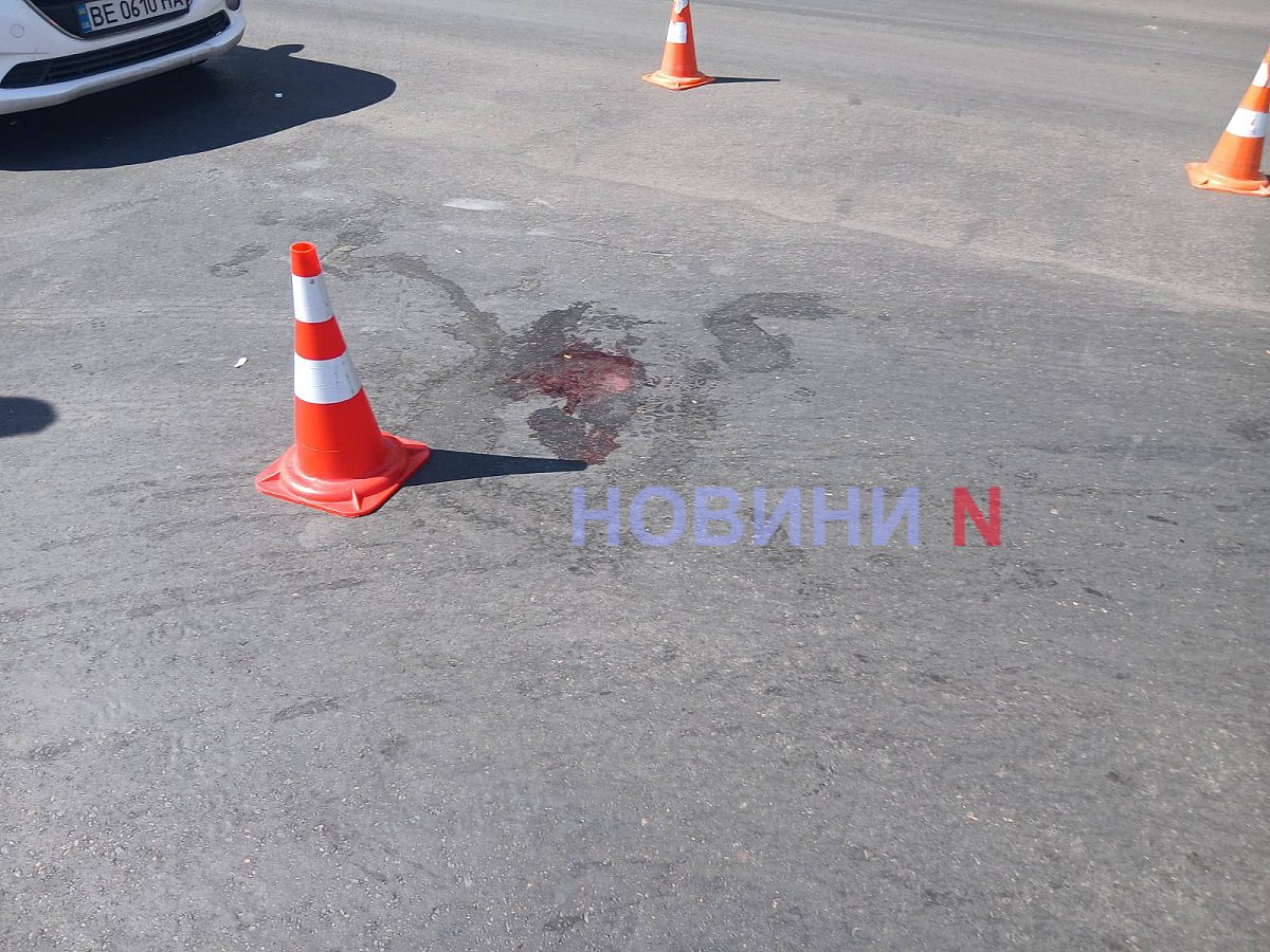 В Николаеве такси сбило женщину: пострадавшую госпитализировали В Николаеве такси сбило женщину: пострадавшую госпитализировали