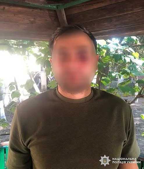 Во Львове двое мужчин напали на подростков: 16-летнего юношу ранили ножом Во Львове двое мужчин напали на подростков: 16-летнего юношу ранили ножом