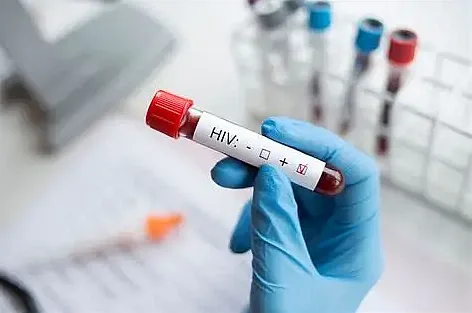 Медики рассказали о ситуации с ВИЧ-инфекцией в Николаевской области в 2026 году Медики рассказали о ситуации с ВИЧ-инфекцией в Николаевской области в 2026 году