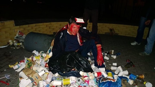 Пилипишина забросили в мусорник и облили краской, когда он пытался зарегистрироваться кандидатом в нардепы