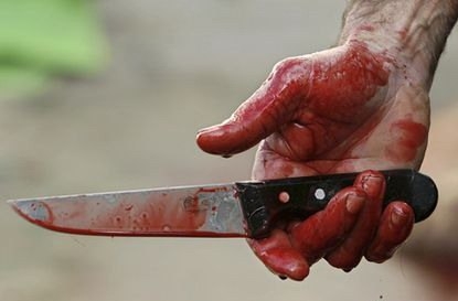 В Николаеве в подъезде дома нашли окровавленного парня: ему нанесли 25 ножевых ранений