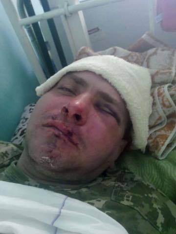 В Измаиле жестоко избили бойца "Правого сектора" 